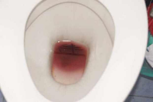 špinění u mužů při vzrušení